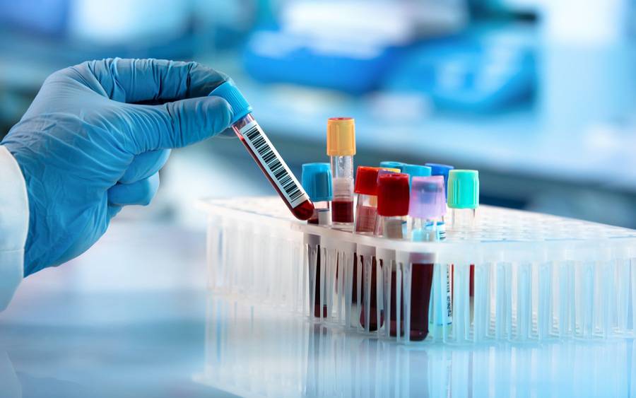 blood tests at home