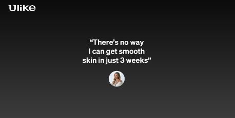 ulike laser hair removal