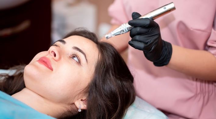 microneedling for hair
